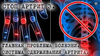 Стоп  Артрит 3 Главная проблема болезни Эффективная система сдерживания артрита